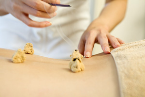 Moxibustion